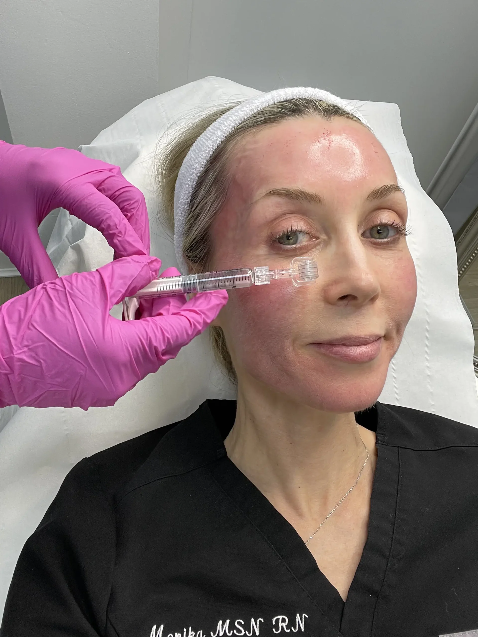 Professional Pigmentation Treatments